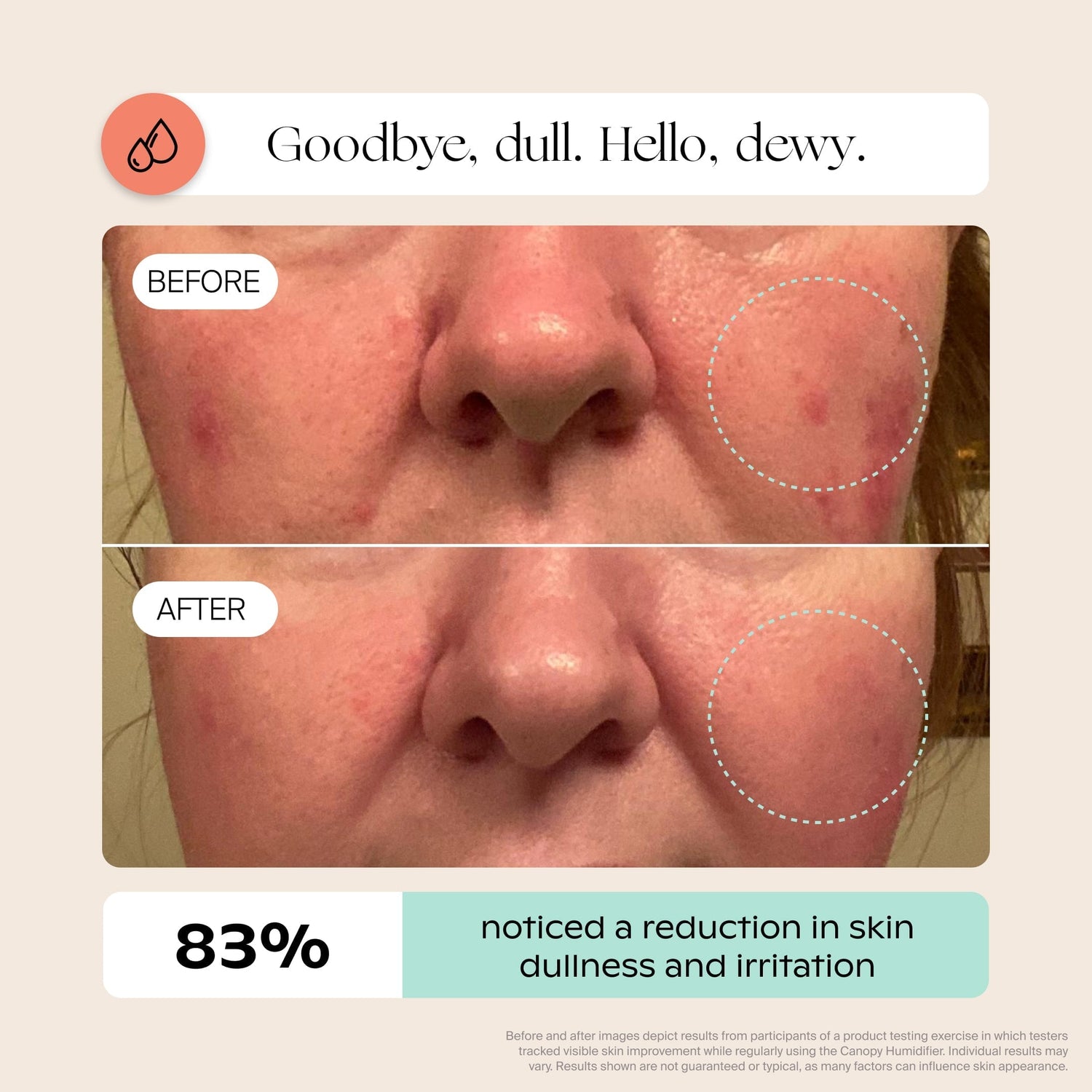 Bedside Humidifier 2.0 | Lifestyle, healthier, more glowing skin in 30 days