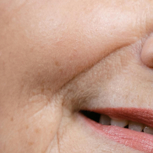 Wrinkles around the mouth showcasing aging skin
