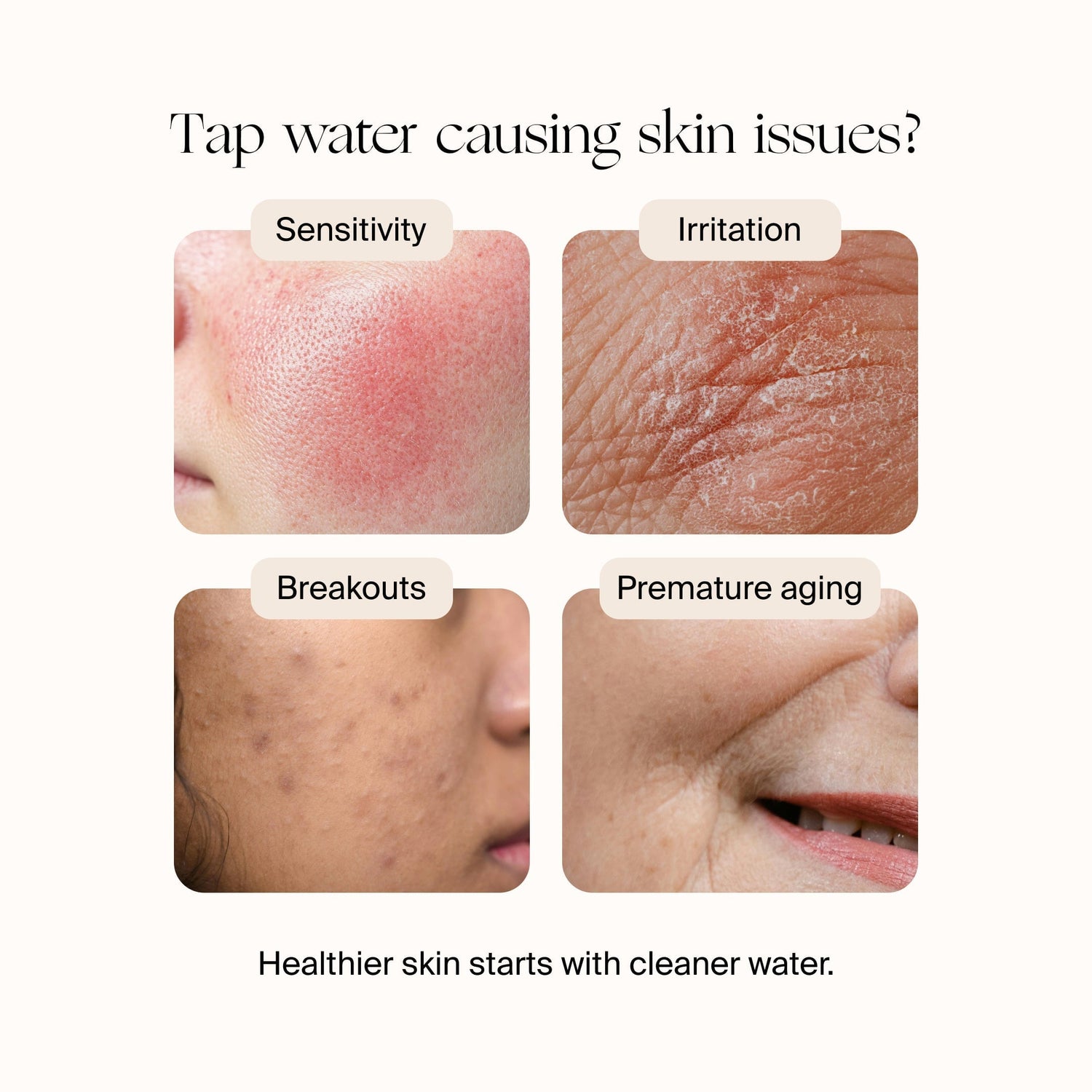 Faucet Filter | Lifestyle, you invest in great skincare so why rinse with dirty tap water. Unfiltered tap water can cause sensitivity, irritation, breakouts, and premature aging