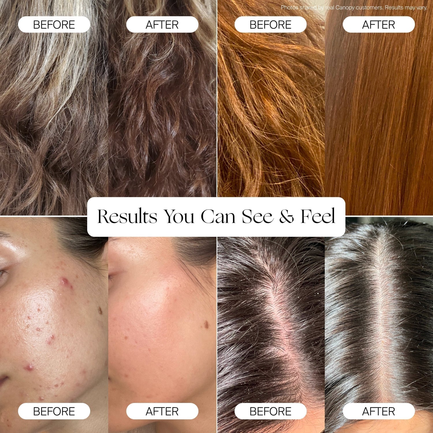Being Frenshe Handheld Filtered Showerhead Set | Lifestyle,  before & after