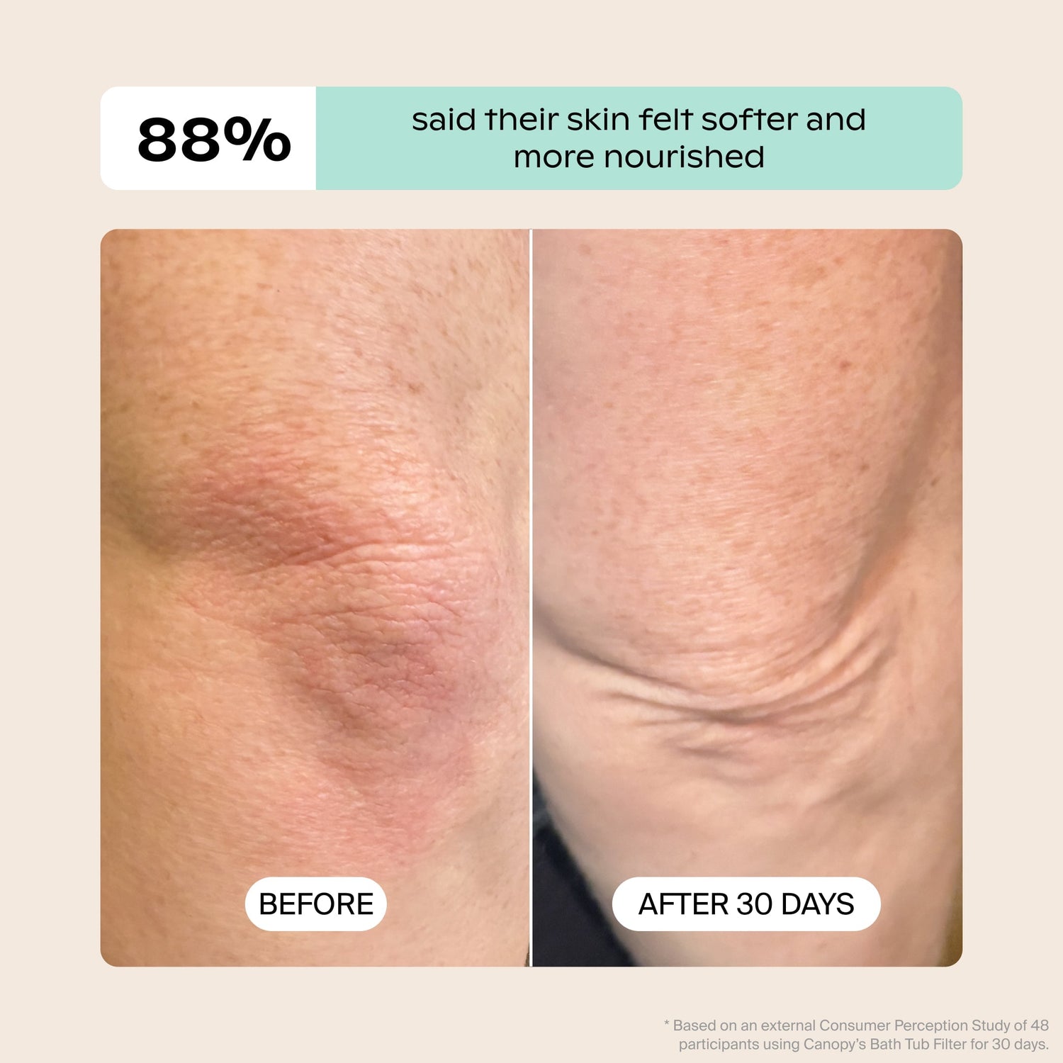 Bath Tub Filter | Lifestyle, Based on an external Consumer Perception Study of 48 participants using Canopy's Bath Tub Filter for 30 days, 88% said their skin felt softer and more nourished